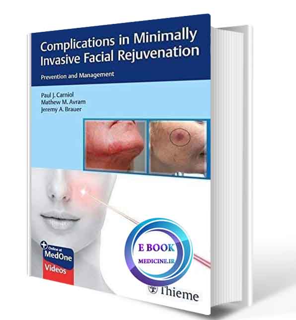 دانلود کتاب Complications in Minimally Invasive Facial Rejuvenation: Prevention and Management  2020( ORIGINAL PDF)